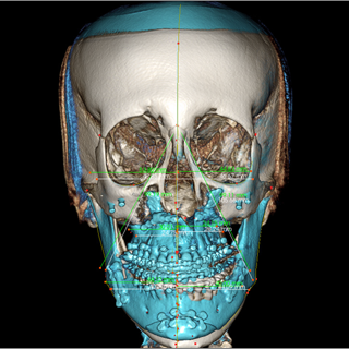 Anatomage invivo viewer download