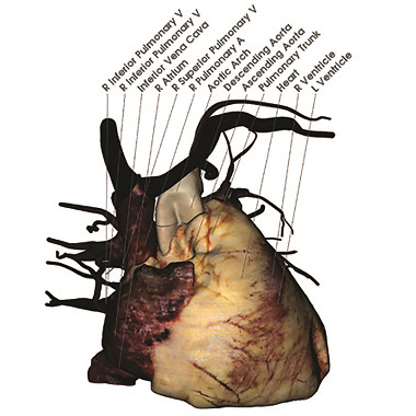 3D heart anatomy