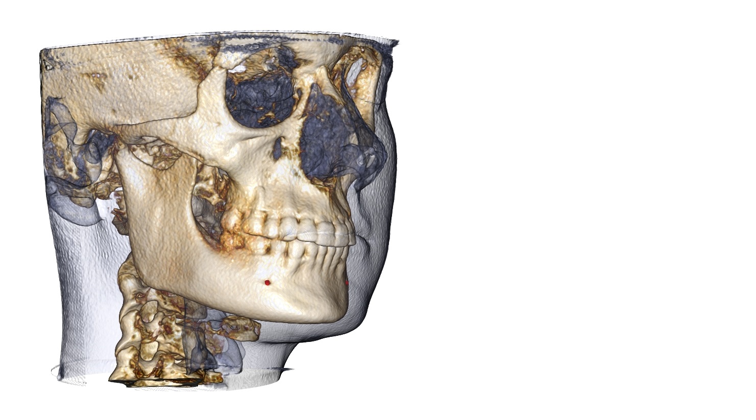 Anatomage In Vivo Viewer