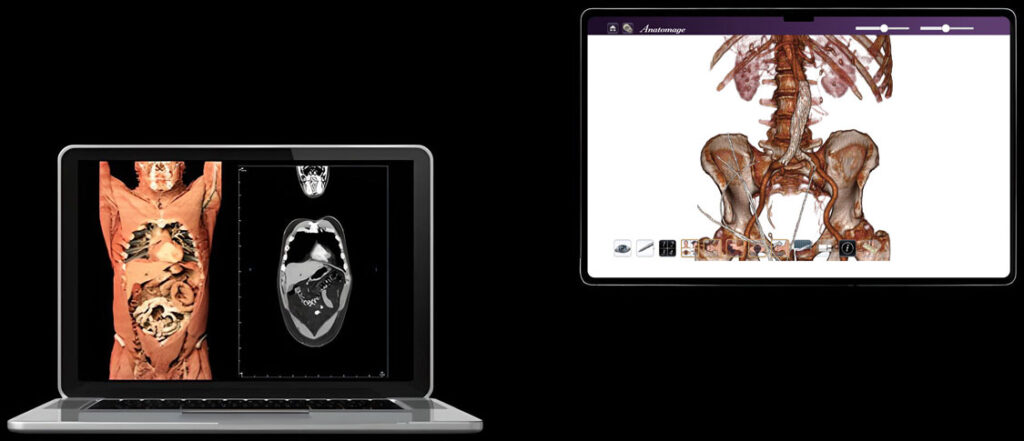 Things Real Body Medical Schools - Anatomage