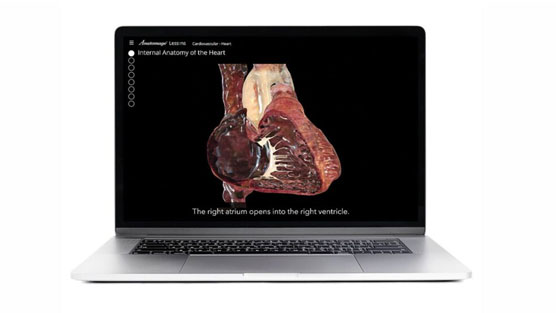 Anatomage’s 3D anatomy platform displaying cardiac arrhythmia on a laptop for healthcare education.
