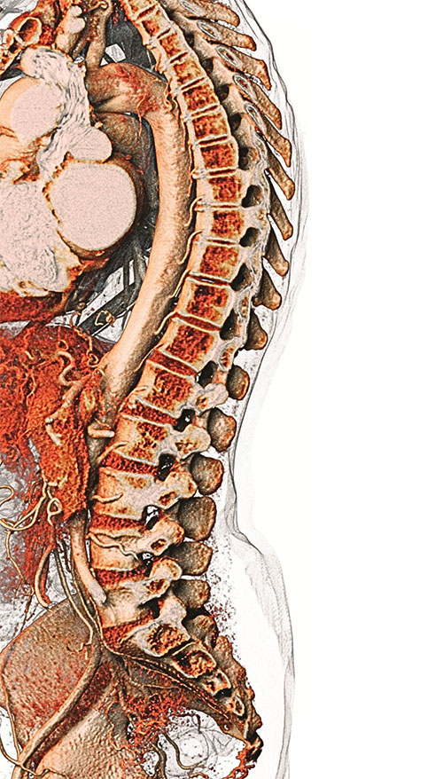 Detailed anatomical scan of the human spine and surrounding vascular structures, captured through advanced 3D imaging for human anatomy study and medical visualization.