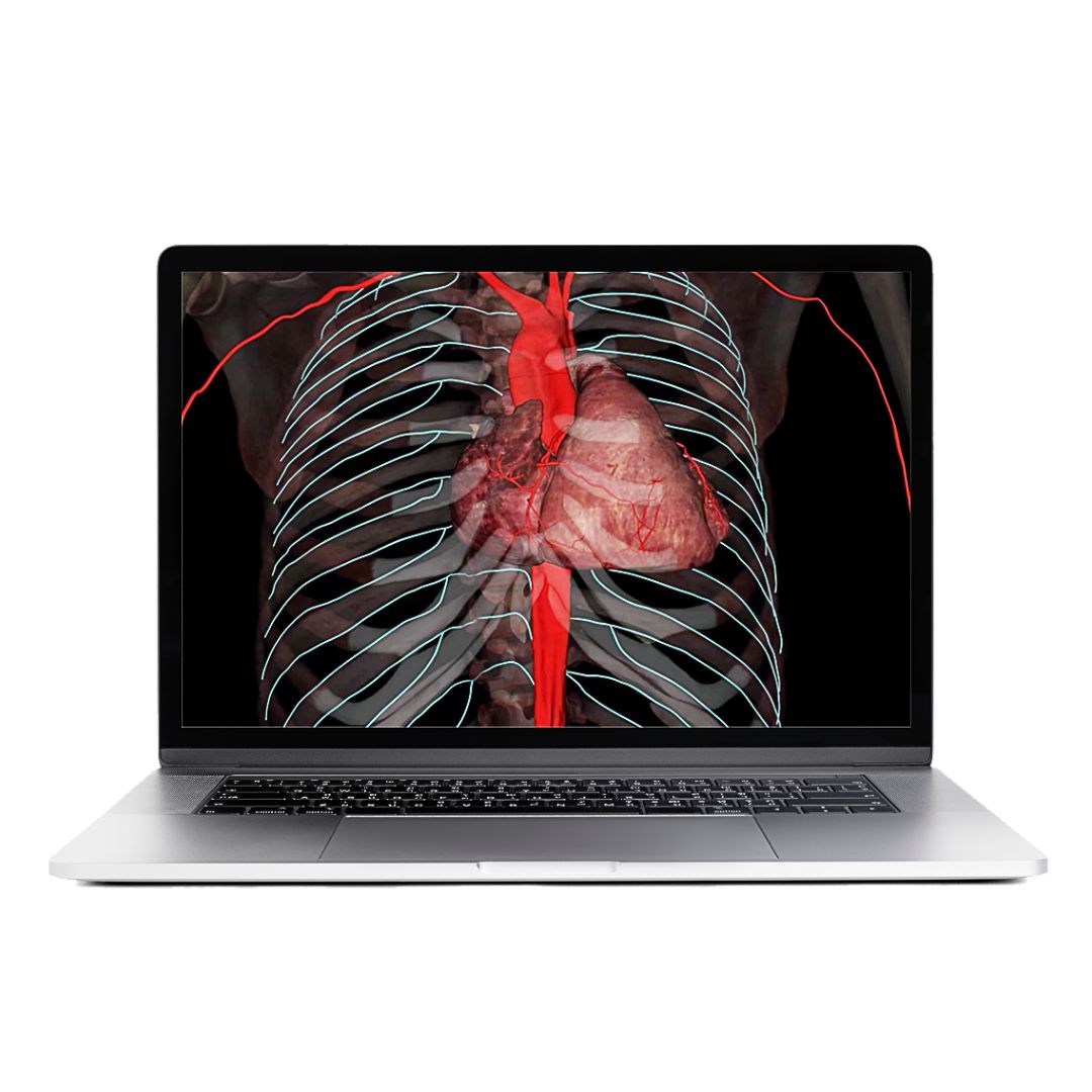 Laptop displaying a 3D visualization of the human heart and ribcage generated through Anatomage’s anatomy software, used in virtual anatomy lessons and medical education curriculum.