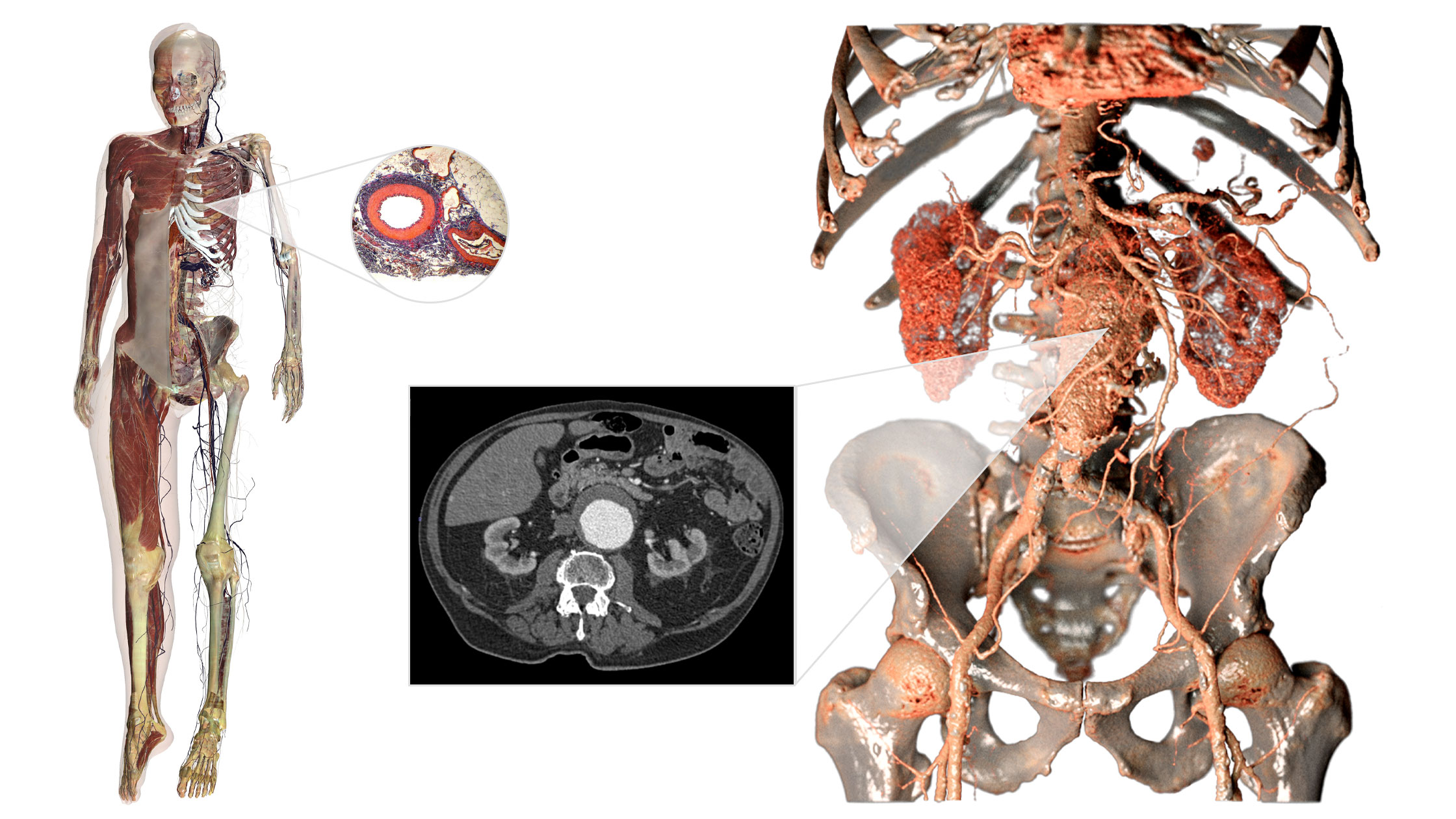 3D visualizations of human anatomy and vascular systems generated from DICOM images and CT scan data on the Anatomage Table, used for medical simulations and advanced anatomy education.