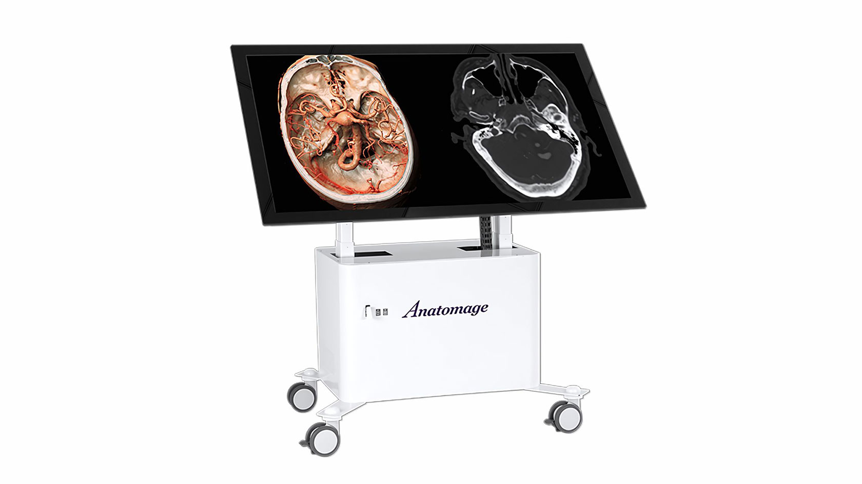 Anatomage Table Clinical displaying DICOM images with advanced 3D anatomy software, designed to enhance medical education through cutting-edge clinical visualization technology.