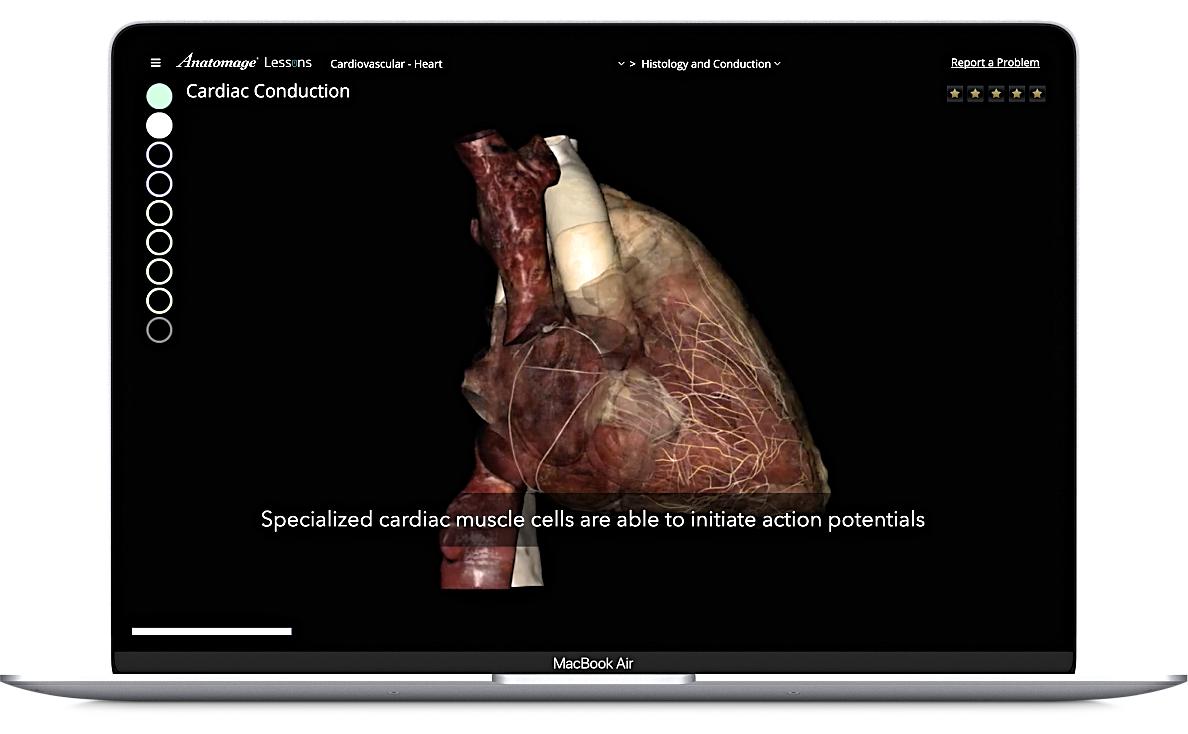 3D heart model displayed on Anatomage Lessons, an anatomy software used for engaging human anatomy and physiology education.