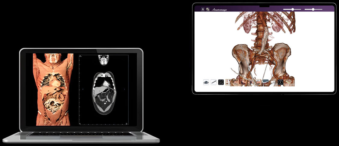 Visualizations shown of 3D pathology images through Anatomage's technology for pathologic anatomy study and medical education.