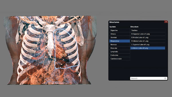 Anatomical structures with over 450 CT/MRI 3D renders.