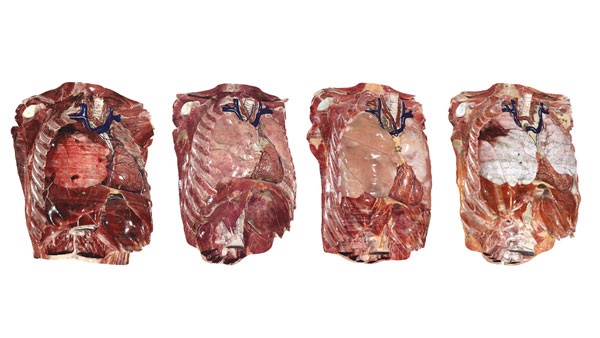 Review natural variations for anatomical structures and regions between multiple cadavers.