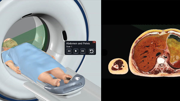 Step-by-step CT scan procedures simulation.