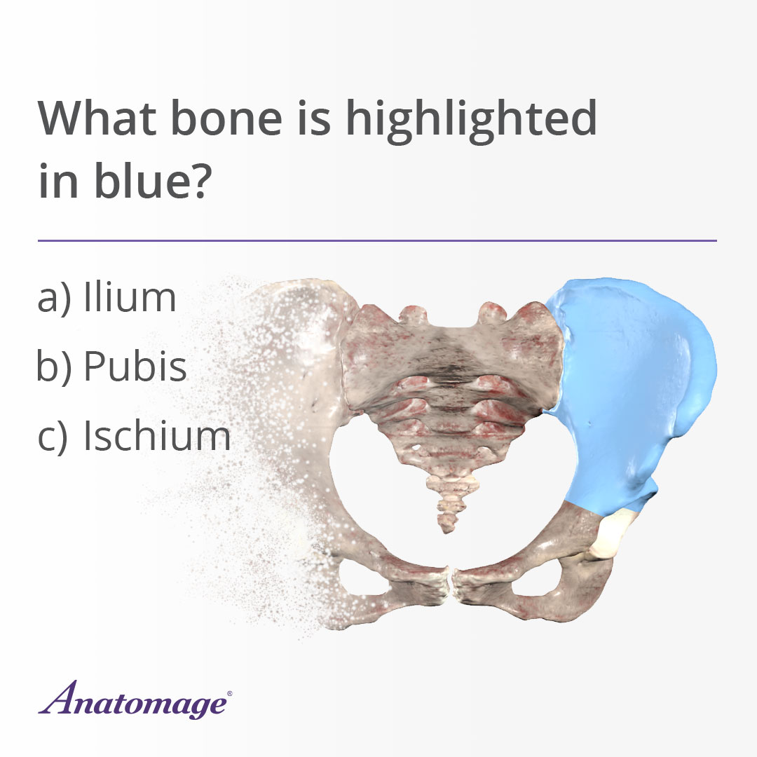 A question asking which bone of the hip is highlighted (ilium).