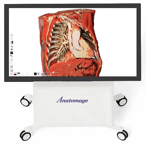 Anatomage Table Clinical showing a 3D anatomical view of the thoracic and abdominal cavity, used in medical and simulation centers for detailed anatomy study and procedural training.