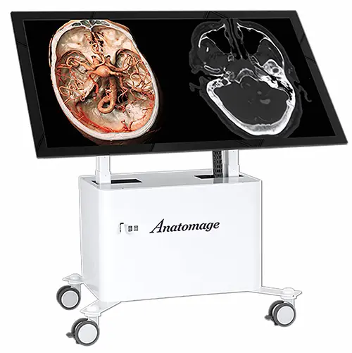 Anatomage Table Clinical displaying DICOM images with advanced 3D anatomy software, designed to enhance medical education through cutting-edge clinical visualization technology.