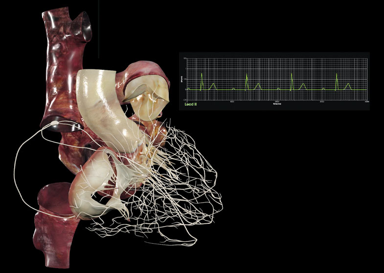 The Anatomage Table offers real-time physiology simulations, like this EKG of a first-degree atrioventricular block (AV block).