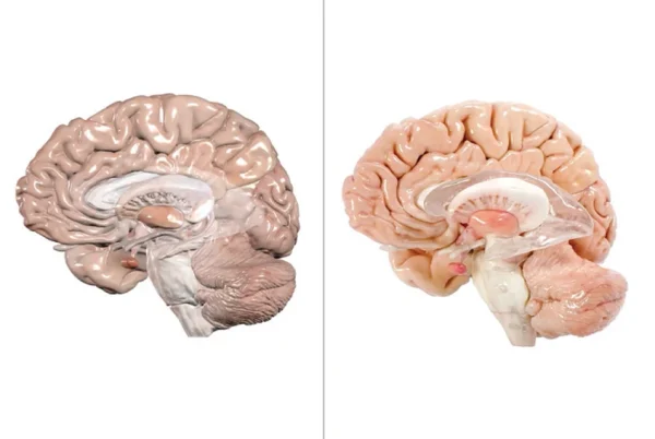Anatomage Replica Brain