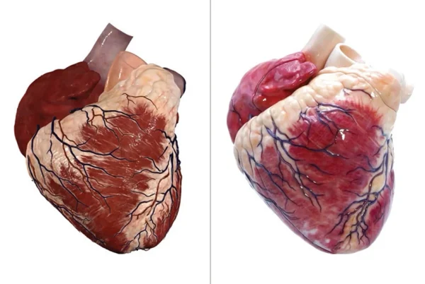 Anatomage Replica Heart