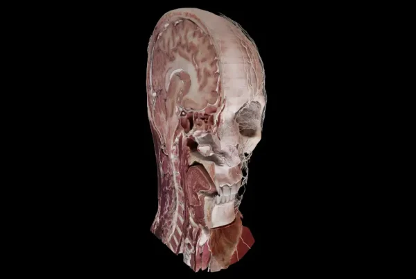 Anatomage-Xtreme-Reality-Clipping