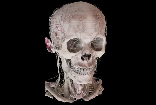 Anatomage-Xtreme-Reality-Head
