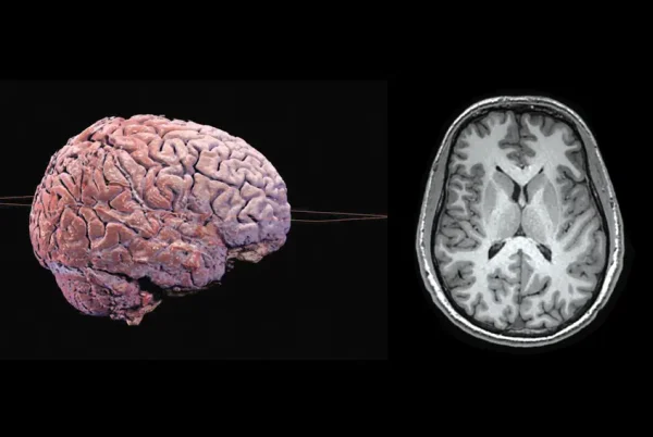 anatomage-theater-brain-scan