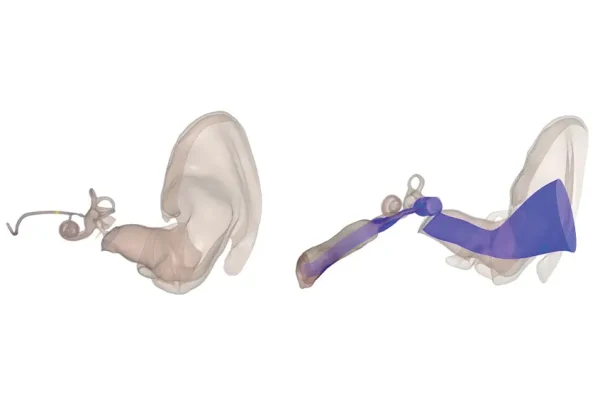 anatomage-theater-ear-physiology