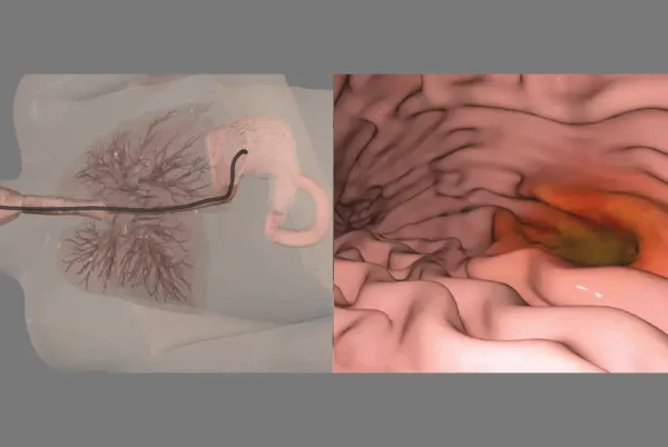 anatomage-theater-endoscopy
