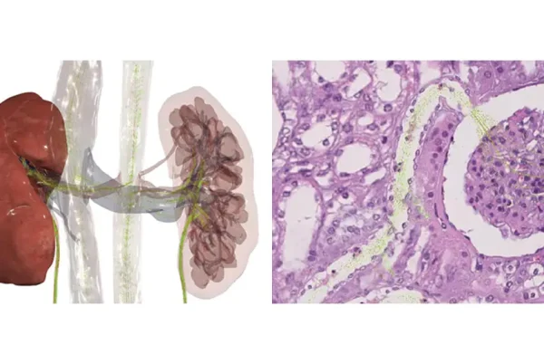 anatomage-theater-renal-physiology